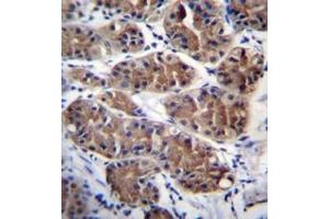 Immunohistochemistry (Paraffin-embedded Sections) (IHC (p)) image for anti-Protocadherin gamma Subfamily C, 5 (PCDHGC5) (AA 498-526), (Middle Region) antibody (ABIN954051)