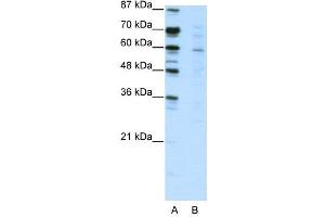 WB Suggested Anti-CBFA2T3  Antibody Titration: 2. (CBFA2T3 抗体  (N-Term))