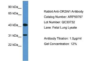 WB Suggested Anti-OR2W1  Antibody Titration: 0. (OR2W1 抗体  (C-Term))