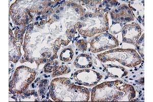 Image no. 2 for anti-Catenin (Cadherin-Associated Protein), beta 1, 88kDa (CTNNB1) antibody (ABIN1496890) (CTNNB1 抗体)