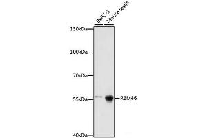 Western blot analysis of extracts of various cell lines using RBM46 Polyclonal Antibody at dilution of 1:1000. (RBM46 抗体)