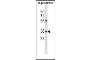 Western Blotting (WB) image for anti-Olfactory Receptor, Family 5, Subfamily AN, Member 1 (OR5AN1) (AA 279-310), (C-Term) antibody (ABIN953877)