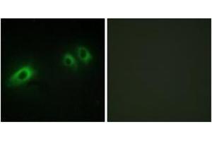 Immunofluorescence analysis of HeLa cells, using LAMB1 Antibody. (Laminin beta 1 抗体  (AA 1721-1770))