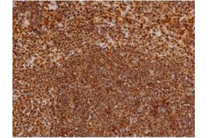 ABIN6267384 at 1/200 staining Mouse spleen tissue sections by IHC-P. (Ezrin 抗体  (pTyr353))