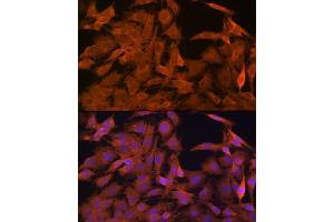 Immunofluorescence analysis of C6 cells using SRP54 Rabbit mAb (ABIN3015958, ABIN3015959, ABIN1682276, ABIN1682277 and ABIN7101466) at dilution of 1:100 (40x lens). (SRP54 抗体)
