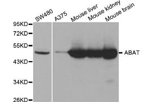 Western blot analysis of extracts of various cell lines, using ABAT antibody. (ABAT 抗体)
