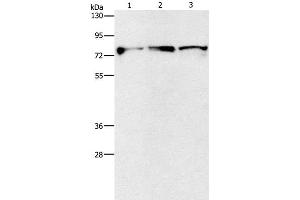 Western Blot analysis of Mouse brain and Human fetal brain tissue, Human brain malignant glioma tissue using KIF3A Polyclonal Antibody at dilution of 1:500 (KIF3A 抗体)