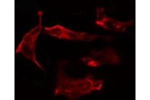 Immunofluorescence (fixed cells) (IF/ICC) image for anti-Cytochrome P450, Family 2, Subfamily J, Polypeptide 2 (CYP2J2) (Internal Region) antibody (ABIN6261201)