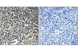 Immunohistochemistry analysis of paraffin-embedded human thymus gland tissue, using CBLN4 Antibody.