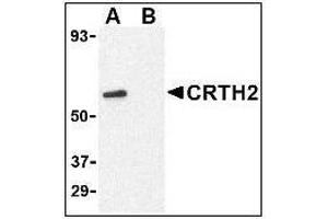 Western blot analysis of CRTH2 in Jurkat cell lysate with at 1 µg/ml in (A) the absence and (B) presence of blocking peptide. (Prostaglandin D2 Receptor 2 (PTGDR2) (N-Term) 抗体)