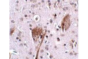 Immunohistochemical staining of mouse brain tissue with 2. (SPG11 抗体  (C-Term))