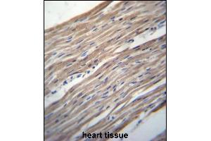 HRC Antibody (Center) (ABIN656657 and ABIN2845898) immunohistochemistry analysis in formalin fixed and paraffin embedded human heart tissue followed by peroxidase conjugation of the secondary antibody and DAB staining. (HRC 抗体  (AA 277-306))