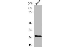 Western Blot analysis of LOVO cells using NPDC-1 Polyclonal Antibody (NPDC1 抗体  (Internal Region))