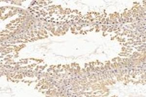Immunohistochemistry analysis of paraffin-embedded rat testis using,RHOBTB3 (ABIN7075422) at dilution of 1: 3600 (RHOBTB3 抗体)