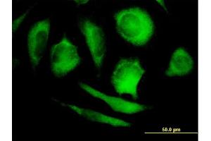 Immunofluorescence of purified MaxPab antibody to PPP5C on HeLa cell. (PP5 抗体  (AA 1-499))
