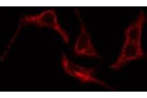 ABIN6276205 staining Hela cells by IF/ICC. (Prostacyclin Receptor 抗体  (Internal Region))