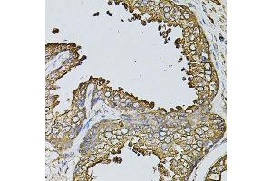Immunohistochemistry (Paraffin-embedded Sections) (IHC (p)) image for anti-Myosin, Light Chain 1, Alkali, Skeletal, Fast (MYL1) (AA 1-150) antibody (ABIN6144241)