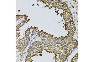 Immunohistochemistry of paraffin-embedded human prostate using MYL1 antibody. (MYL1 抗体  (AA 1-150))