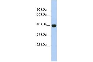 WB Suggested Anti-KIAA1191 Antibody Titration: 0. (KIAA1191 抗体  (Middle Region))