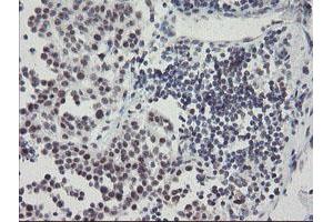 Image no. 5 for anti-SUMO1/sentrin/SMT3 Specific Peptidase 2 (SENP2) (AA 139-523) antibody (ABIN1490931)