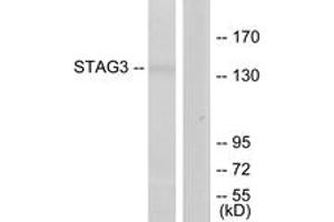 Western blot analysis of extracts from Jurkat cells, using STAG3 Antibody. (STAG3 抗体  (AA 1161-1210))