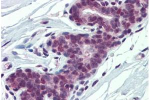 Human Breast: Formalin-Fixed, Paraffin-Embedded (FFPE) (PCBP1 抗体  (AA 208-257))