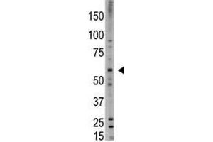 Image no. 1 for anti-Bone Morphogenetic Protein 6 (BMP6) (N-Term) antibody (ABIN357184) (BMP6 抗体  (N-Term))