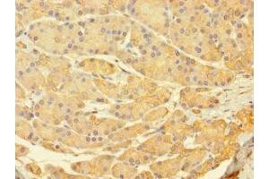 Immunohistochemistry of paraffin-embedded human pancreatic tissue using ABIN7174731 at dilution of 1:100 (PARP11 抗体  (AA 1-245))