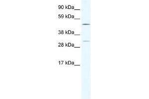 WB Suggested Anti-CAMK4 Antibody Titration:  2. (CAMK4 抗体  (C-Term))