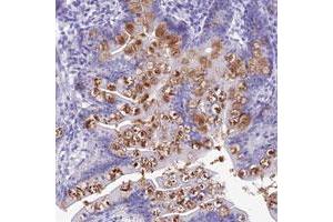 Immunohistochemical staining of human small intestine with KDELR3 polyclonal antibody  shows moderate cytoplasmic positivity in goblet cells of glandular cells at 1:50-1:200 dilution. (KDELR3 抗体)