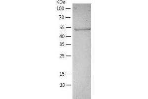 Western Blotting (WB) image for RNA Guanine-7 Methyltransferase (RNMT) (AA 1-476) protein (His-IF2DI Tag) (ABIN7123316)