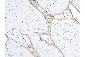 IHC analysis of ANXA3 using anti-ANXA3 antibody (ABIN6719269). (Annexin A3 抗体  (AA 23-323))