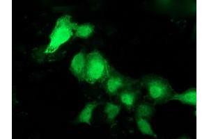 Anti-PNMT mouse monoclonal antibody (ABIN2454539) immunofluorescent staining of COS7 cells transiently transfected by pCMV6-ENTRY PNMT (RC206586). (PNMT 抗体)