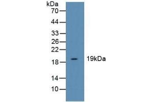Detection of CFL1 in Human Liver Tissue using Polyclonal Antibody to Cofilin 1 (CFL1) (Cofilin 抗体  (AA 3-161))