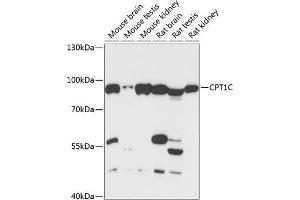 Western blot analysis of extracts of various cell lines, using CPT1C antibody (ABIN6130131, ABIN6138980, ABIN6138981 and ABIN6217987) at 1:3000 dilution. (CPT1C 抗体  (AA 270-400))