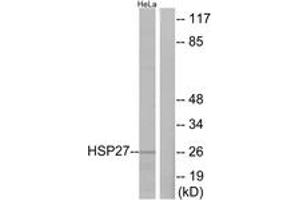 Western blot analysis of extracts from HeLa cells, treated with Ca2+, using HSP27 (Ab-82) Antibody. (HSP27 抗体  (AA 48-97))