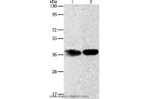 Western blot analysis of Hela cell and mouse kidney tissue, using ADPRHL2 Polyclonal Antibody at dilution of 1:500 (ADPRHL2 抗体)