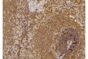ABIN6258774 and ABIN6274538 at 1/100 staining Rat spleen tissue by IHC-P.