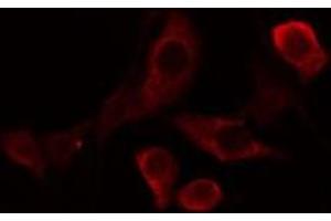 ABIN6275810 staining Hela cells by IF/ICC. (TBXAS1 抗体  (N-Term))