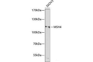 Western blot analysis of extracts of SKOV3 cells using MSH4 Polyclonal Antibody at dilution of 1:1000. (MSH4 抗体)