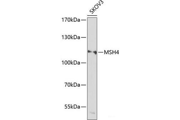 MSH4 antibody