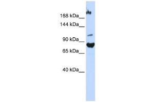 FBXO11 antibody used at 1 ug/ml to detect target protein. (FBXO11 抗体  (Middle Region))