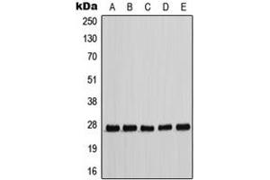 Western blot analysis of p27 Kip1 (pT198) expression in HEK293T EGF-treated (A), MCF7 (B), NIH3T3 (C), Raw264. (CDKN1B 抗体  (C-Term, pSer198))