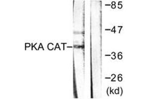Western blot analysis of extracts from mouse brain cells, using PKA alpha/beta CAT (Ab-197) Antibody. (PKA alpha/beta Cat (AA 166-215) 抗体)