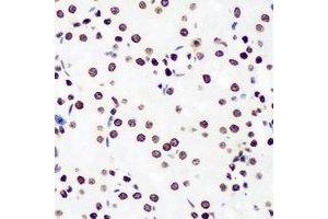 Immunohistochemical analysis of DDX41 staining in rat kidney formalin fixed paraffin embedded tissue section. (DDX41 抗体)