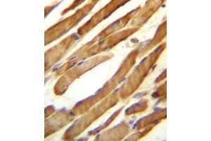 SLC16A10 Antibody (C-term) (ABIN657159 and ABIN2846293) immunohistochemistry analysis in formalin fixed and paraffin embedded human skeletal muscle followed by peroxidase conjugation of the secondary antibody and DAB staining. (SLC16A10 抗体  (C-Term))