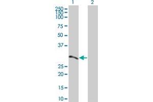 Western Blotting (WB) image for ATF2 293T Cell Transient Overexpression Lysate(Denatured) (ABIN1331421)