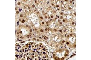 Immunohistochemistry (IHC) image for anti-E74-Like Factor 3 (Ets Domain Transcription Factor, Epithelial-Specific) (ELF3) antibody (ABIN7306568)
