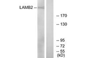 Western Blotting (WB) image for anti-Laminin, beta 2 (Laminin S) (LAMB2) (AA 61-110) antibody (ABIN2890003) (LAMB2 抗体  (AA 61-110))