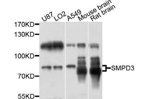 Western blot analysis of extracts of various cell lines, using SMPD3 antibody (ABIN6003882) at 1/1000 dilution. (SMPD3 抗体)